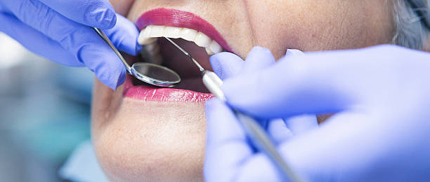 Best Emergency Treatment for Dental Infections or Abscesses in Shell Kno, MO